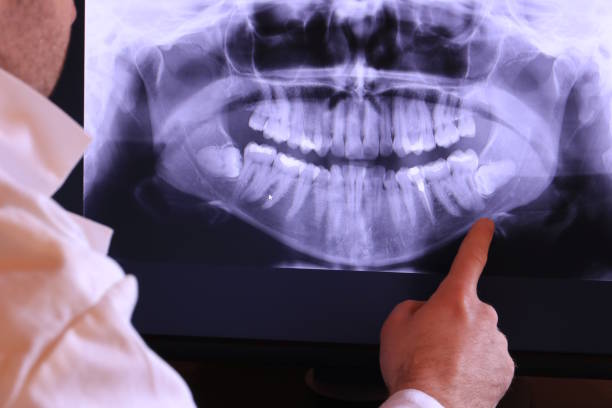 Best Emergency Treatment for Dental Infections or Abscesses in Walters, OK