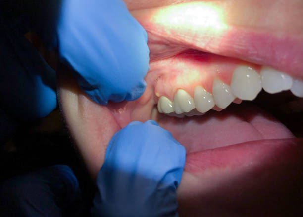 Best Emergency Dental Care for Broken or Chipped Teeth in Walters, OK