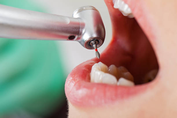 Best Same-Day Emergency Dental Services in Walters, OK